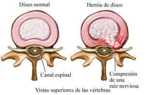 vertebras